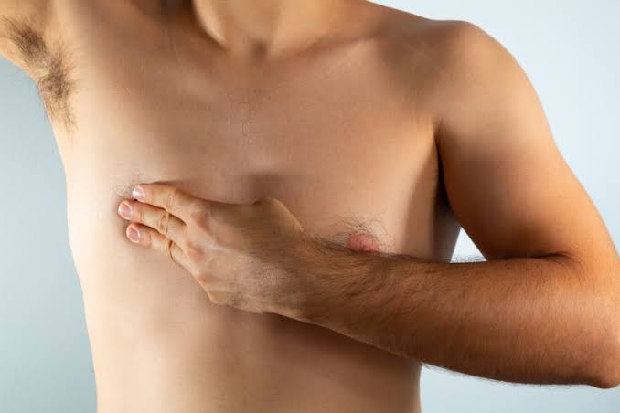 Men Can Also Have Breast Cancer – UITH CMD